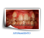Apiñamiento